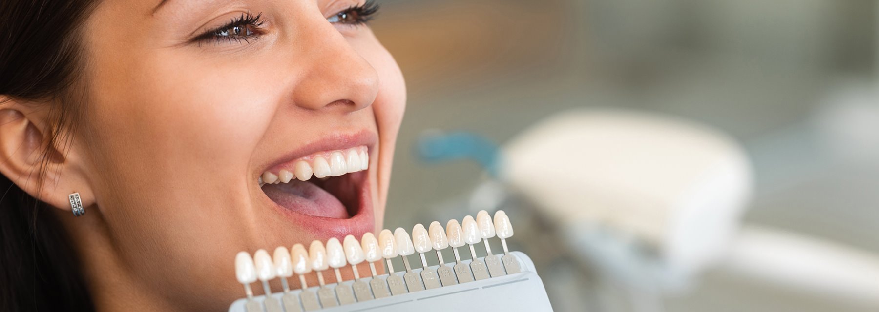 Cosmetic Services - Dobbin Dental